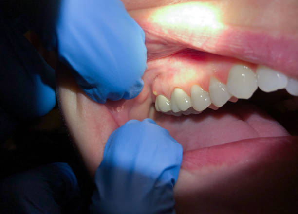 Best Walk-In Emergency Dental Services in Linden, TN